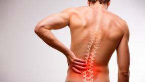 Rückenbeschwerden selber heilen